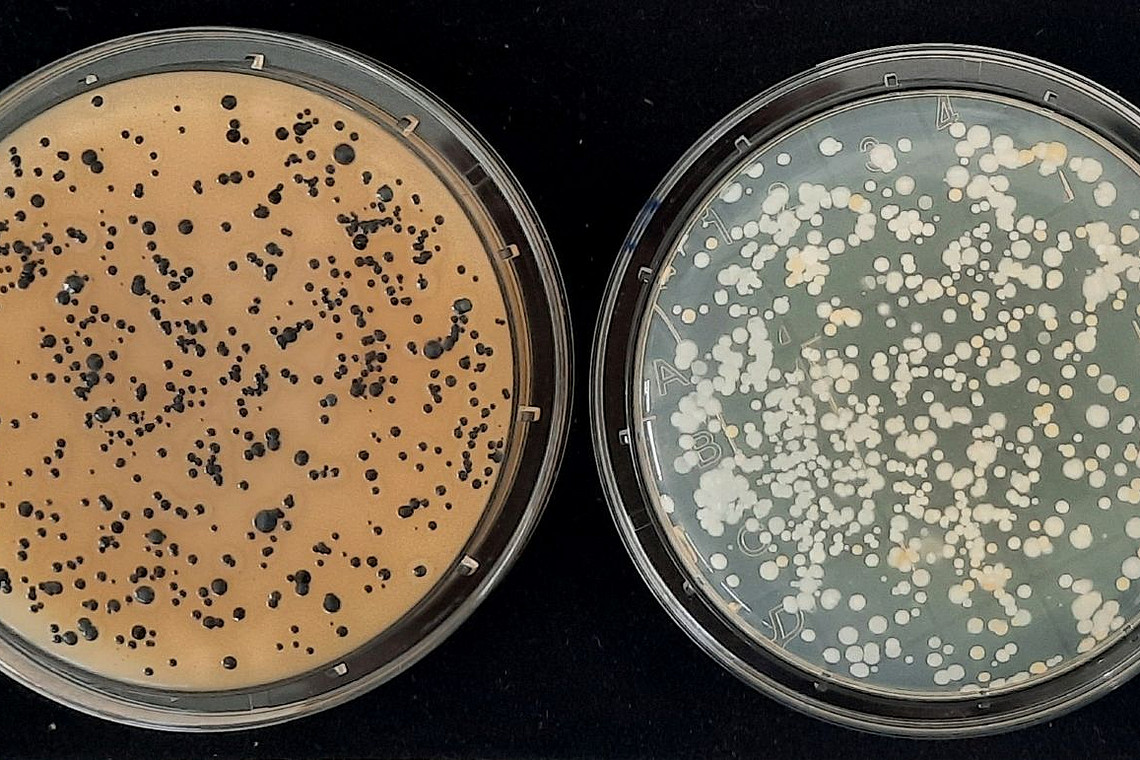 Mit den Abklatschplatten lassen sich Aussagen treffen, wie viele Organismenkolonien auf einer bestimmten Fl&auml;che vorhanden sind.