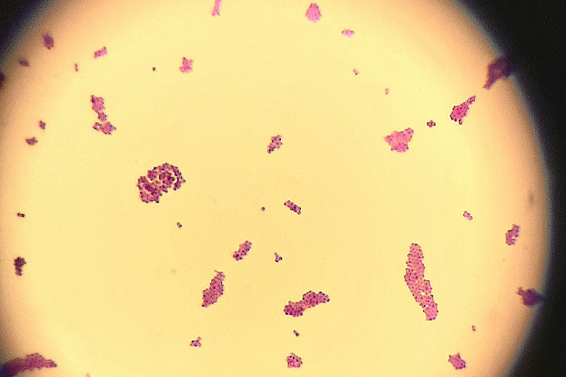 Grampositive Koggen, hier in der Sicht durch das Mikroskop.