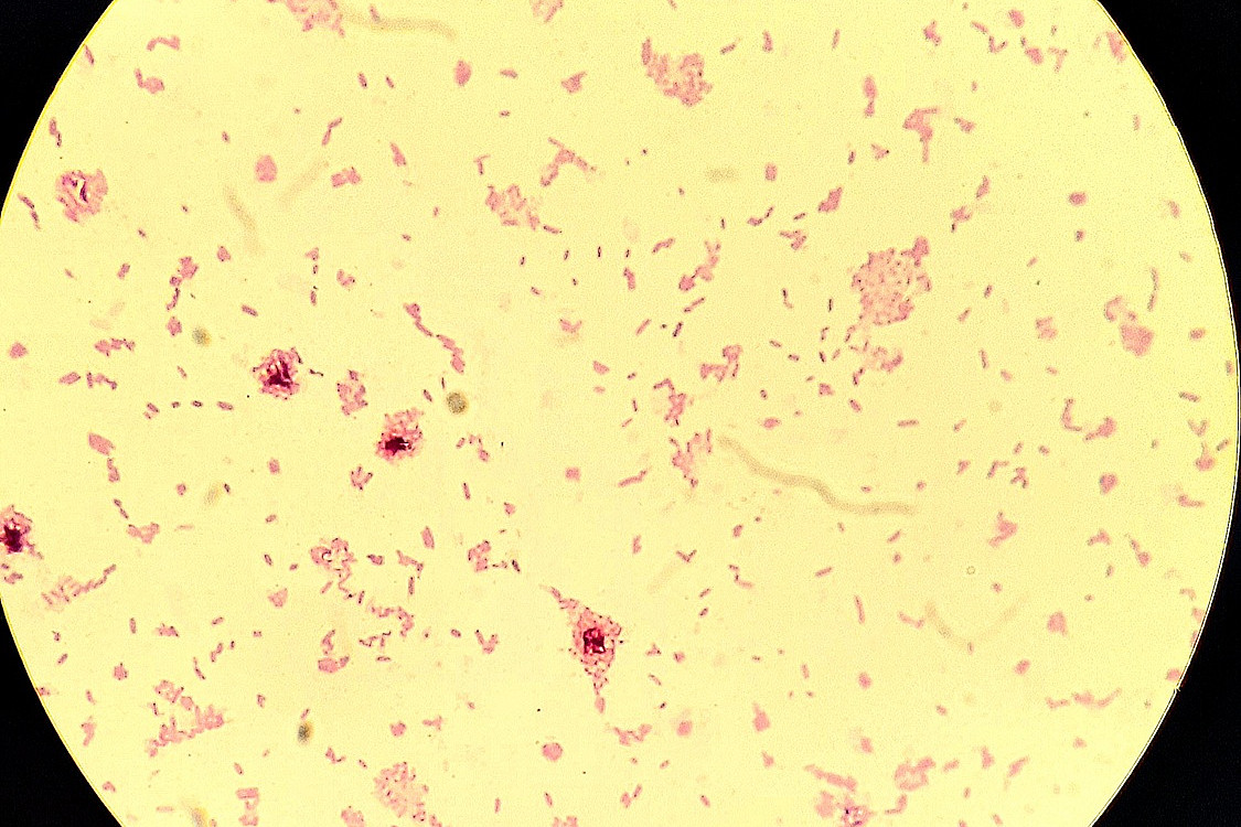 Sicht auf gramnegative St&auml;bchen.